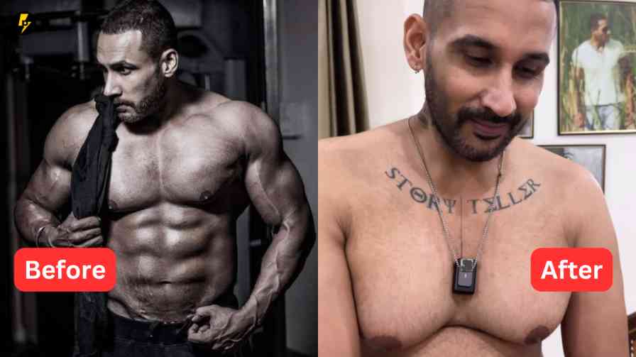 Bodybuilder Tarun Gill's kidneys failed? Why did his body become like this? Side effects of steroids